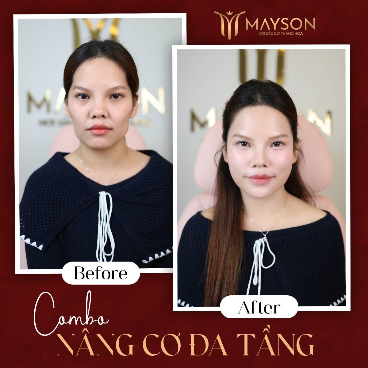 Kết quả nâng cơ