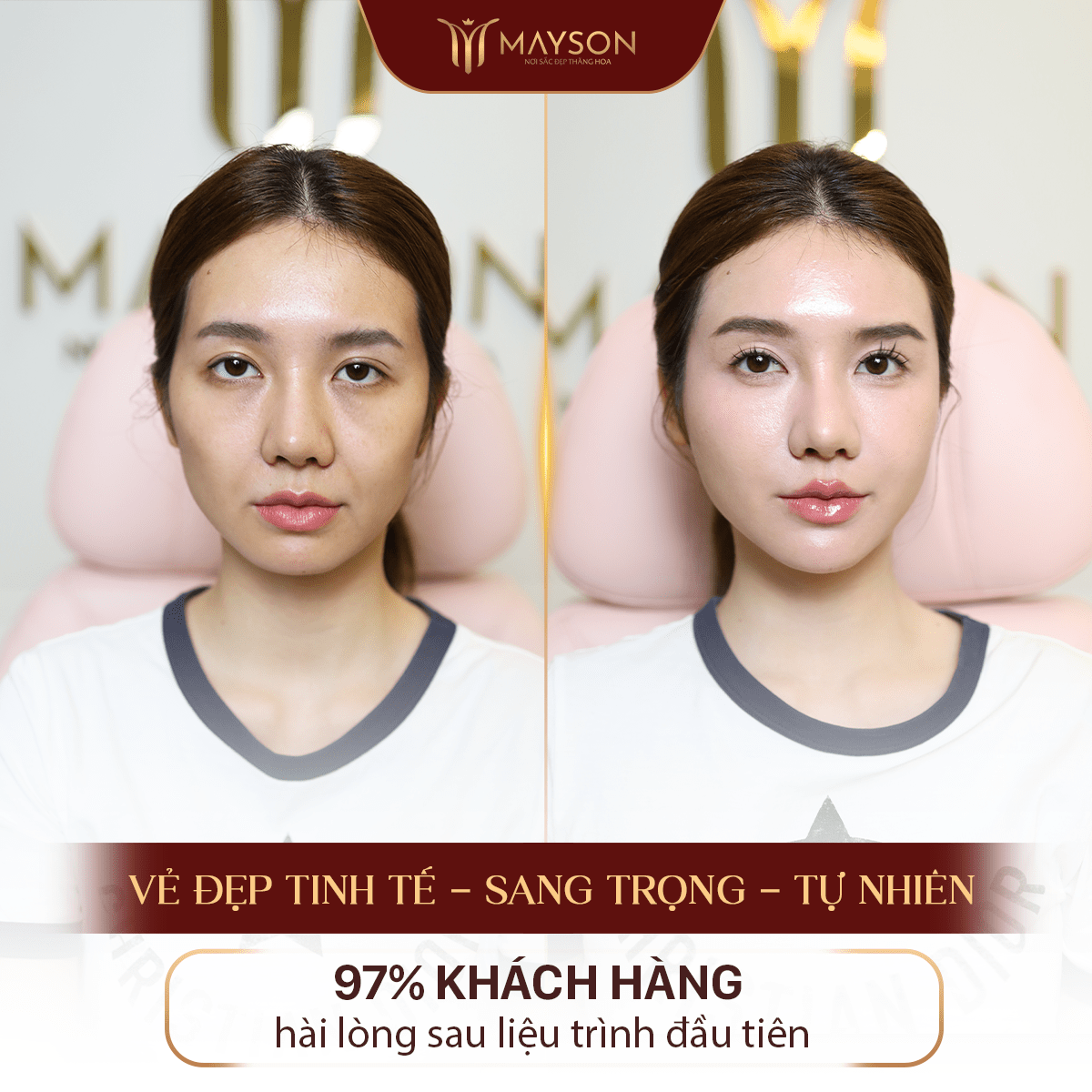 Kết quả nâng cơ